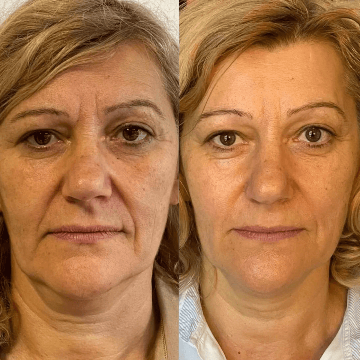 DUO ROLLER & GUA SHA