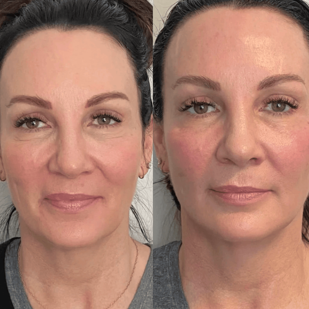 DUO ROLLER & GUA SHA